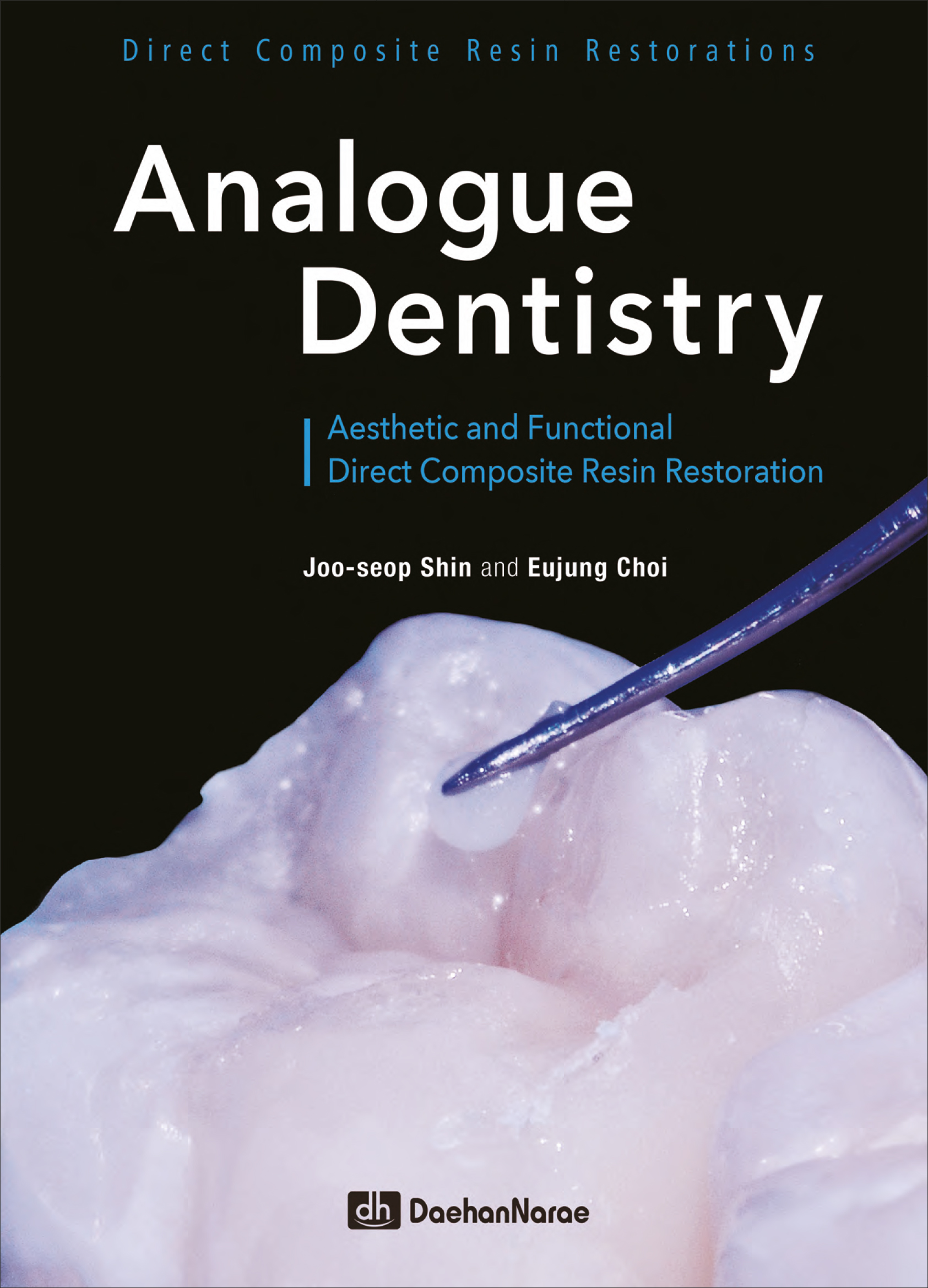 Analogue Dentistry: 심미적이고 기능적인 직접 레진 수복