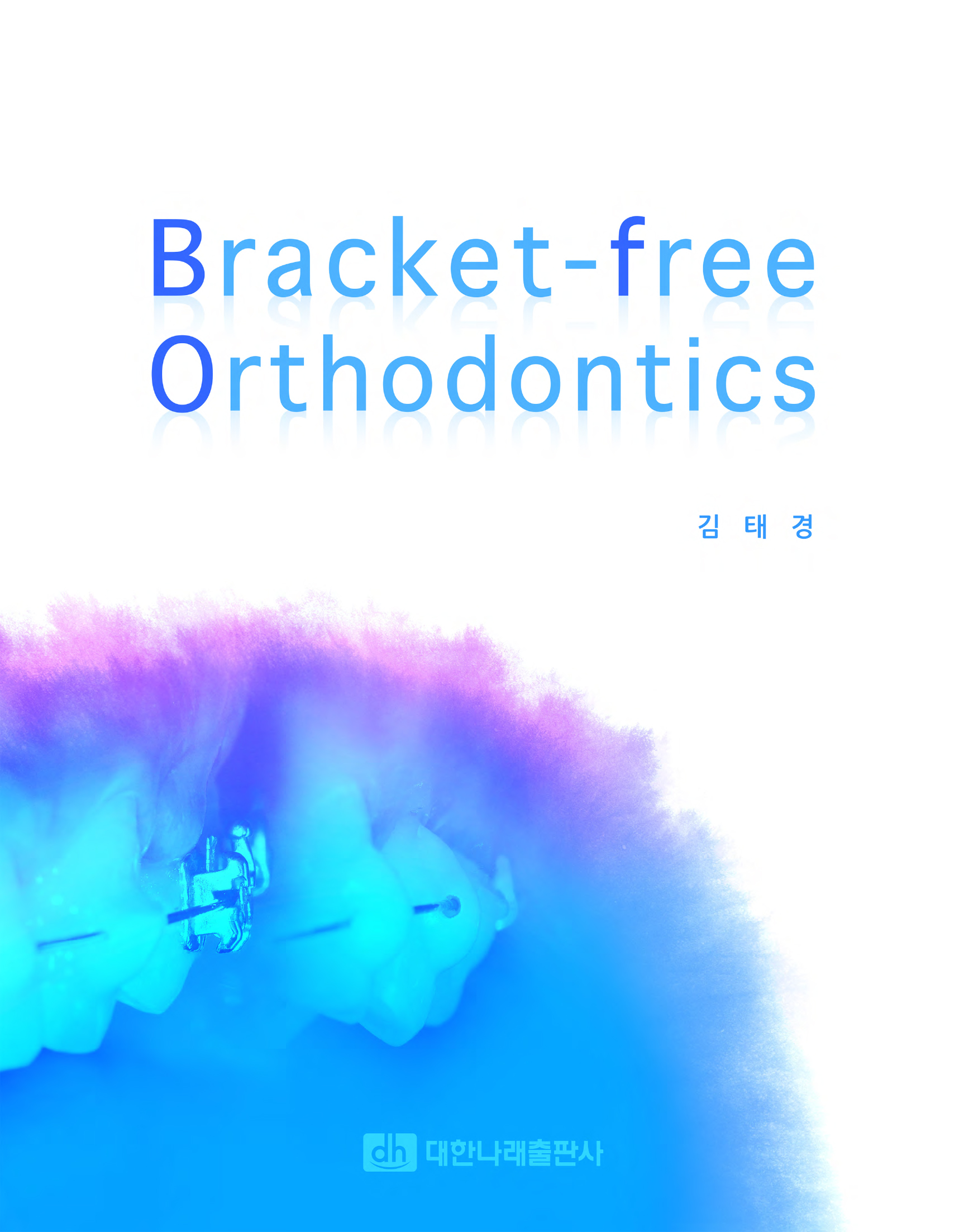 Bracket-free Orthodontics