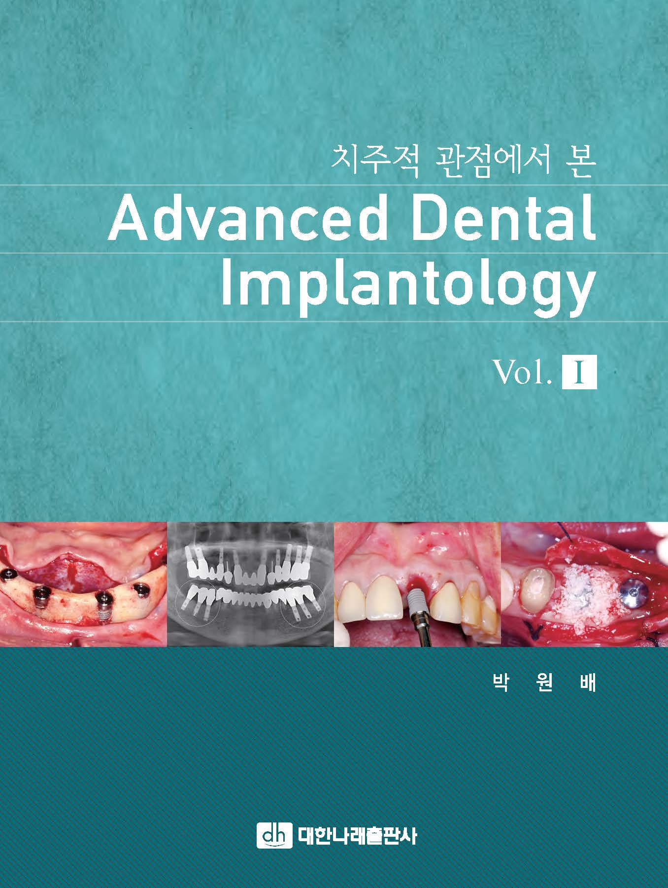 치주적 관점에서 본 Advanced Dental Implantology - Vol. I