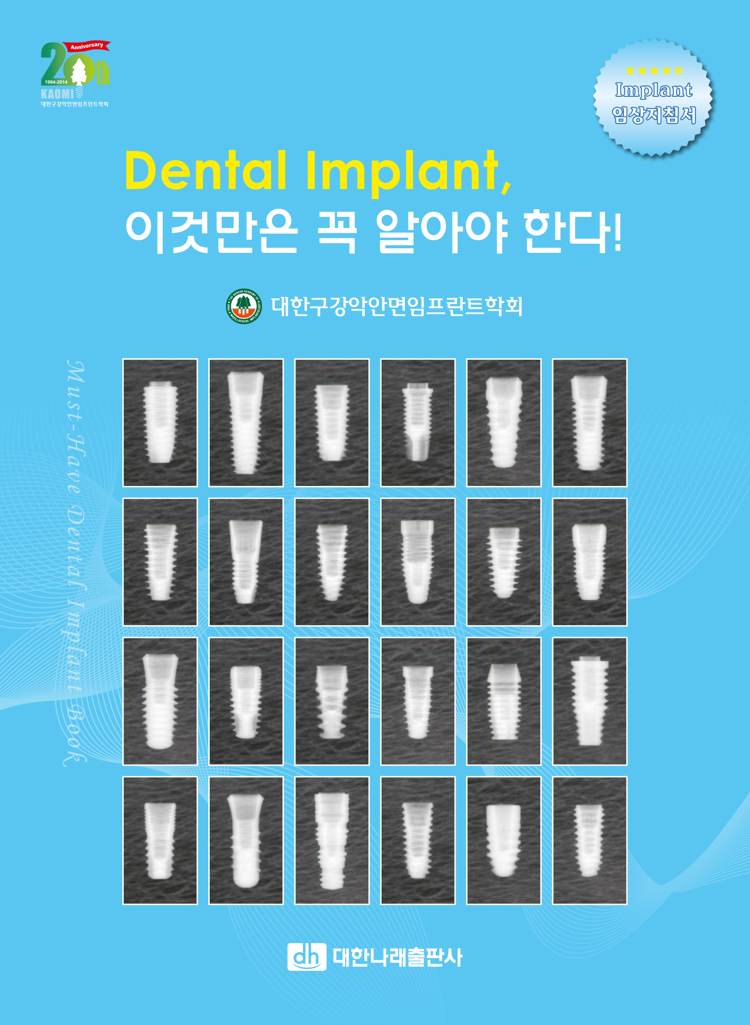 Dental Implant, 이것만은 꼭 알아야 한다!